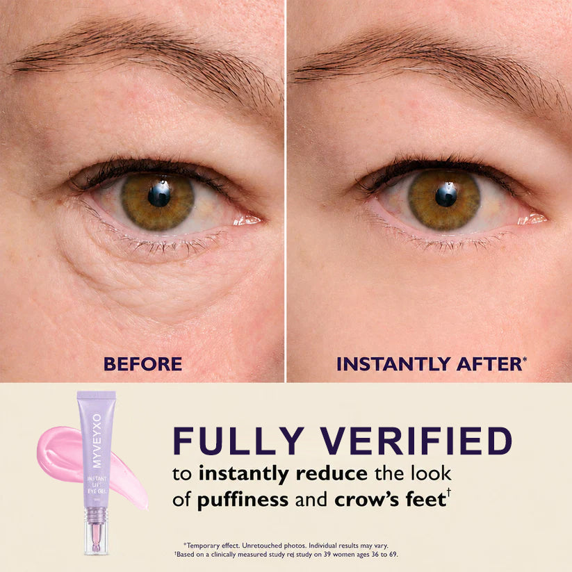 Instant Eye Tightener - Tightens, Firms, & Blurs Wrinkles