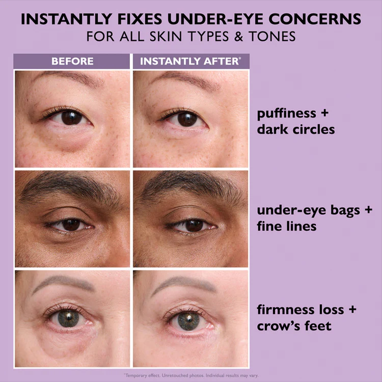 Instant Eye Tightener - Tightens, Firms, & Blurs Wrinkles