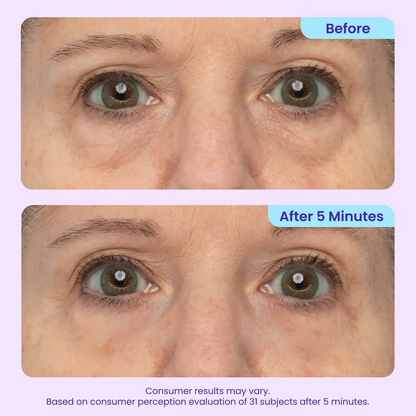 Instant Eye Tightener - Tightens, Firms, & Blurs Wrinkles