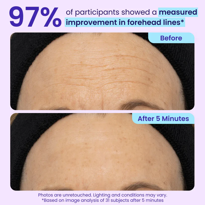 Instant Eye Tightener - Tightens, Firms, & Blurs Wrinkles