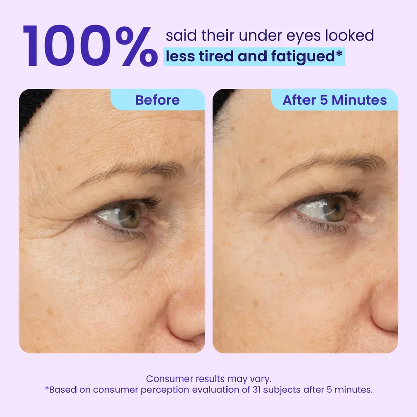 Instant Eye Tightener - Tightens, Firms, & Blurs Wrinkles