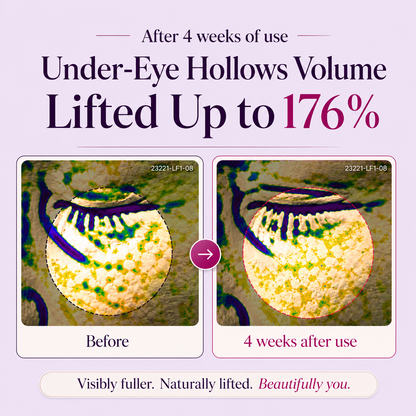 LOVILDS™ Calcium Dark Spot Eye Cream
