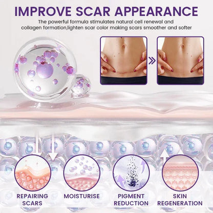 LOVILDS ReGenScar Stem Cell Scar Gel