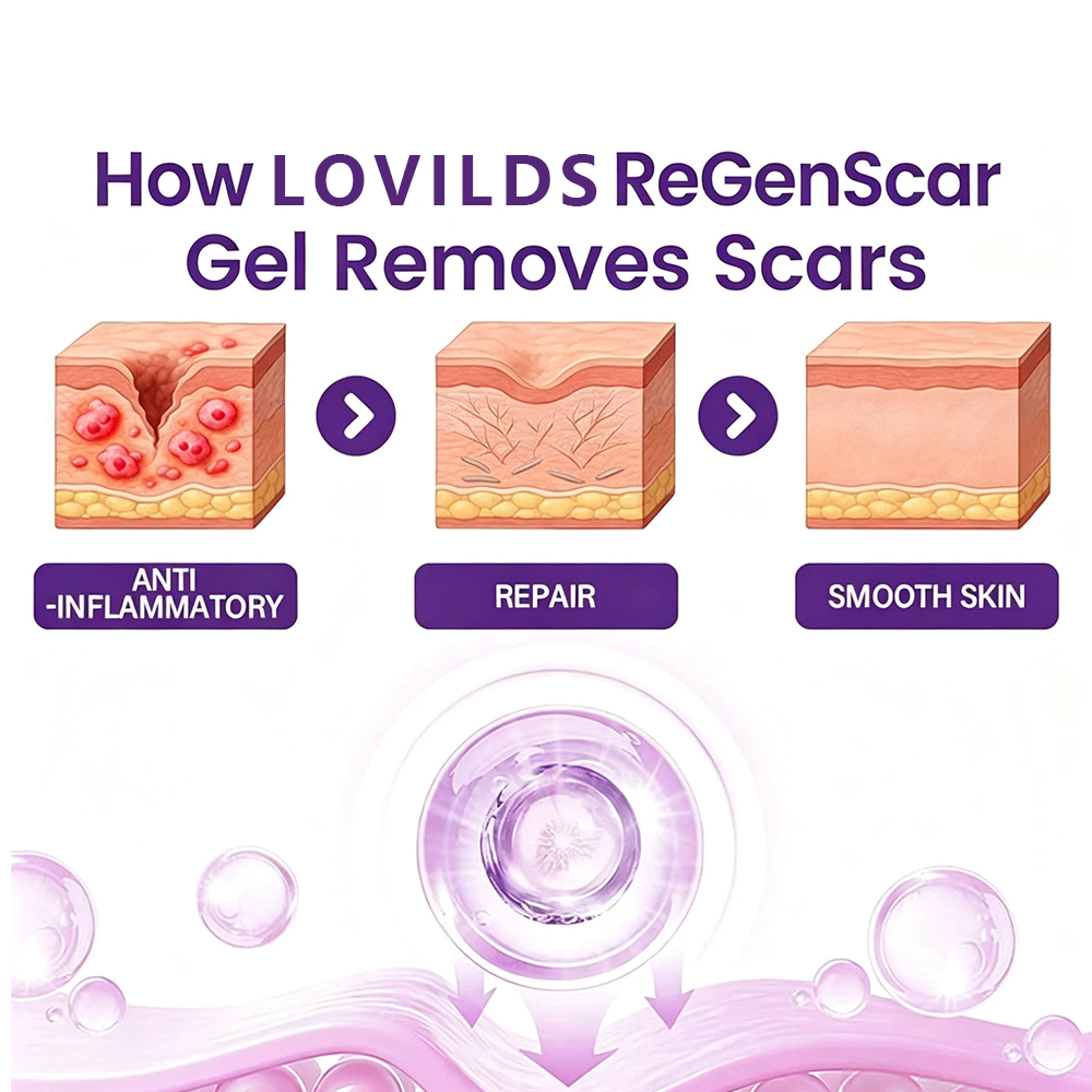 LOVILDS ReGenScar Stem Cell Scar Gel