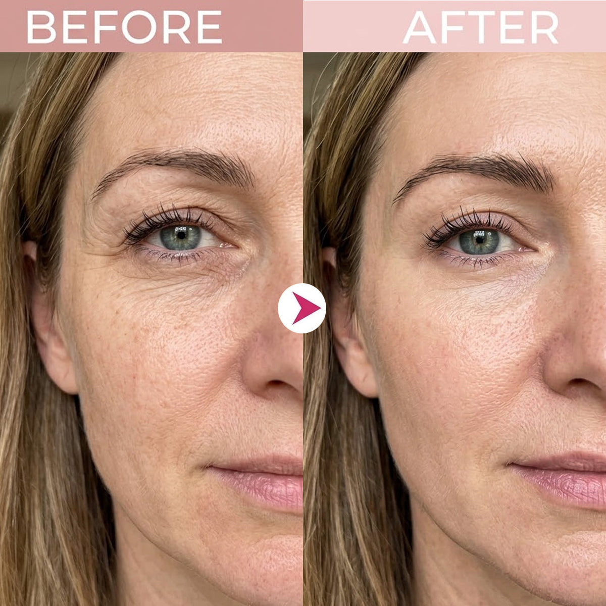 🔥 [Last Day Buy 1 Get 1 Free] P7 Eye Renewal Crème