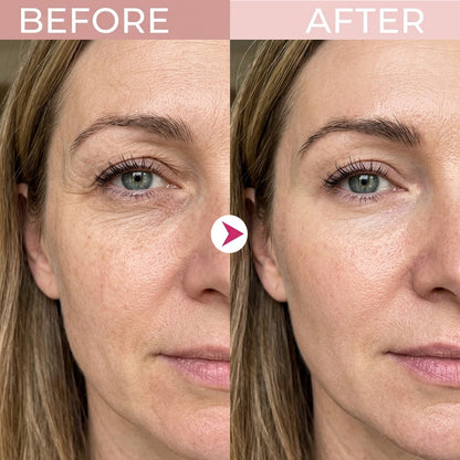 🔥 [Last Day Buy 1 Get 1 Free] P7 Eye Renewal Crème