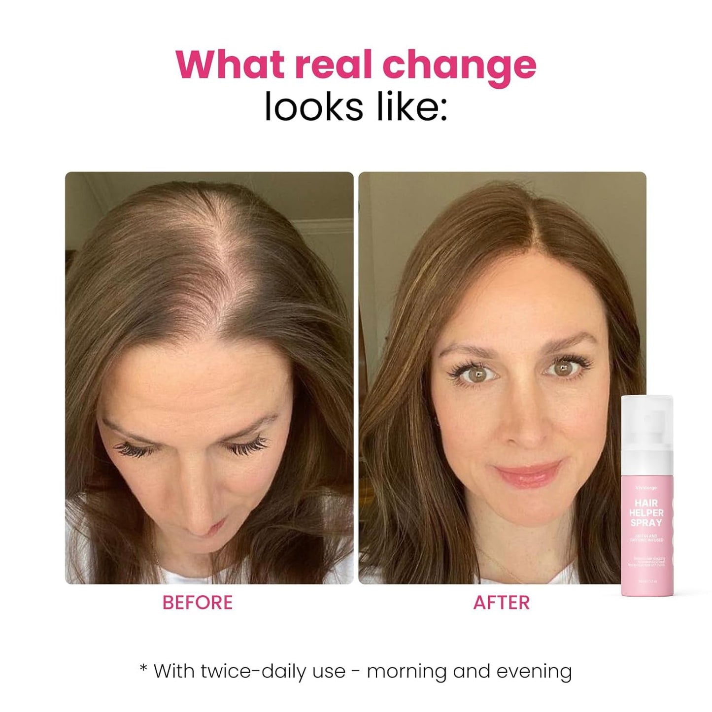 💖Last day: 20% off for a limited time | Vividorge Hair Helper Spray