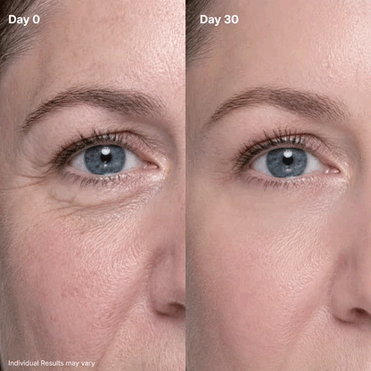 🔥 [Last Day Buy 1 Get 1 Free] P7 Eye Renewal Crème